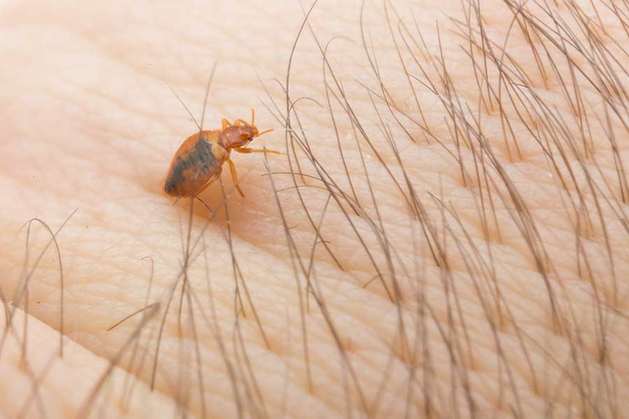 Bed Bug on skin near body hair